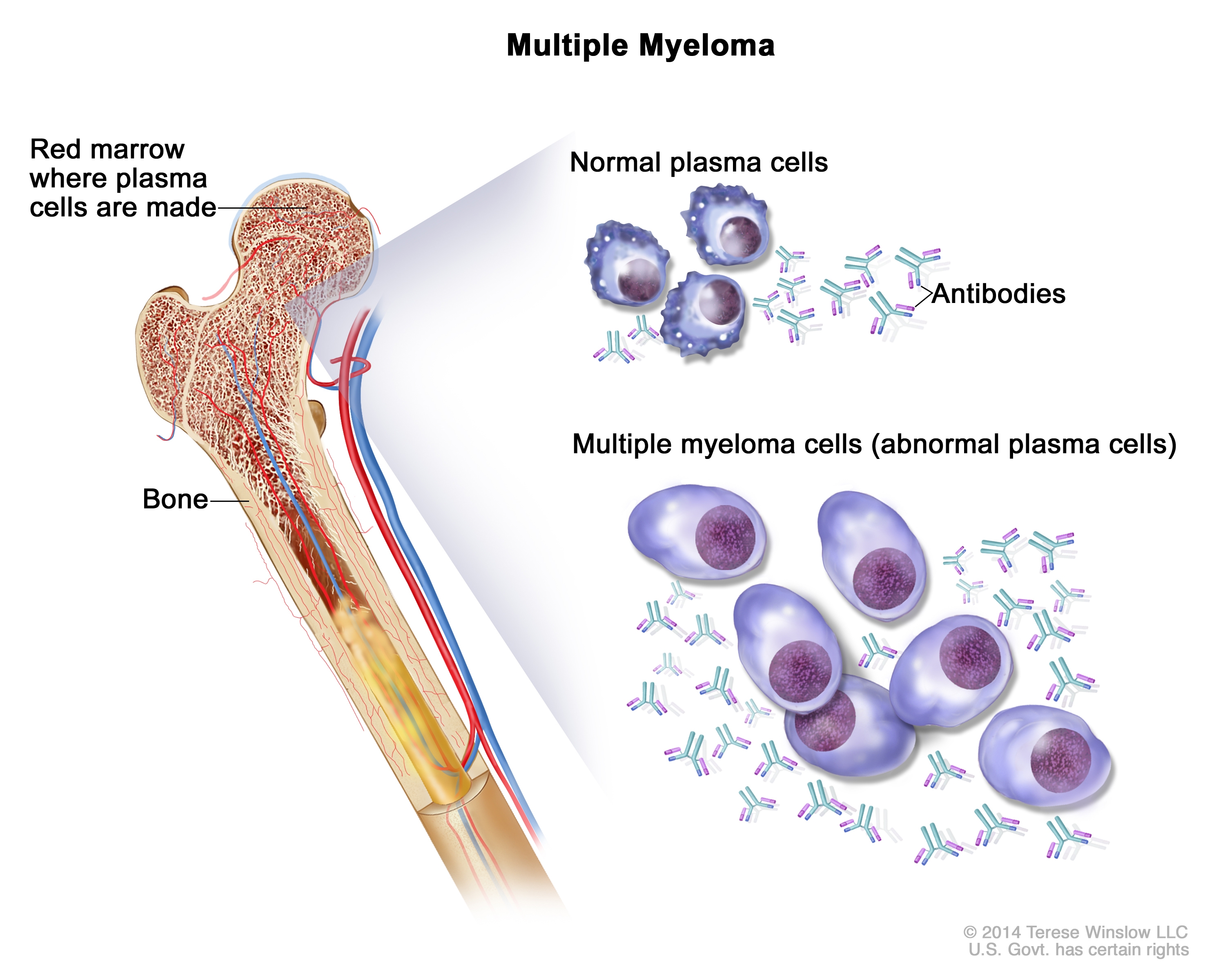 Created for the National Cancer Institute, http://www.cancer.gov